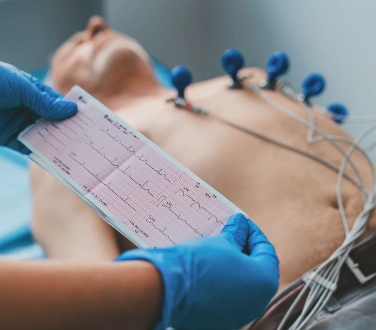 badanie ekg